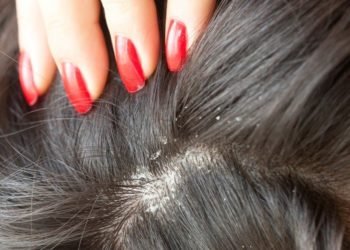 Seborrheic Dermatitis & Dandruff Treatment in mumbai, india