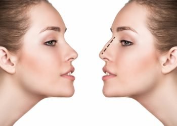 Everything You Should Know About Septoplasty Surgery in mumbai india