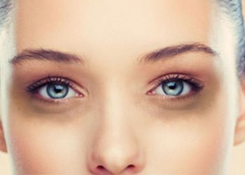 5 reasons to go for treatment for dark circles in mumbai india
