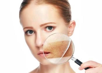 Treatments-for-Dark-Skin-Pigmentation-in-mumbai-india