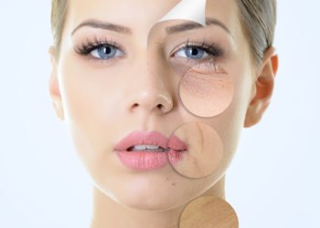 All about Juvederm India treatment