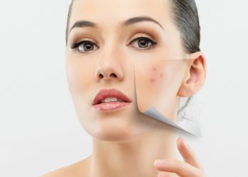 Now you don’t have to live with scars anymore