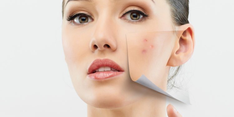 Now you don’t have to live with scars anymore