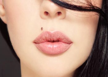 An overview of warts and moles removal treatment in India