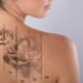 Get effective & easier tattoo removal treatment in India - visit The Esthetic Clinics