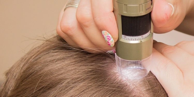 How a Trichologist in Mumbai can help to boost the health of your hair