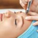Latest advancement in microdermabrasion treatment in India