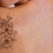 Permanent tattoo removal in mumbai process in brief