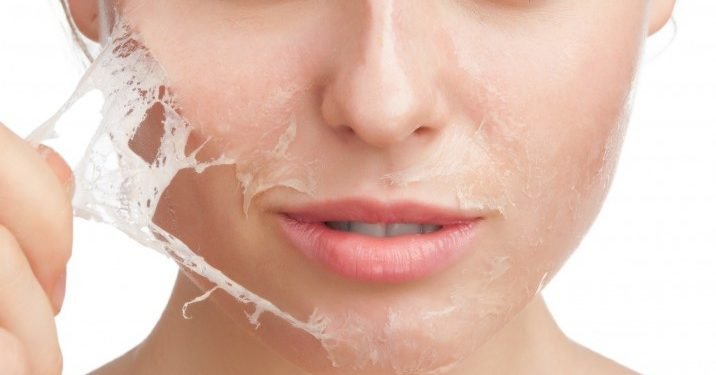 Skin Peeling Treatment - Improve the Appearance of the Skin