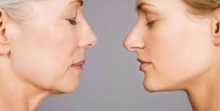 When do you need a face lifting treatment