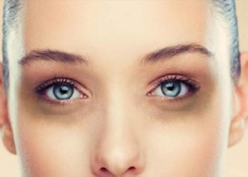Get Rid Of Those Panda Eyes With Proven Dark Circle Removal Treatments In Mumbai
