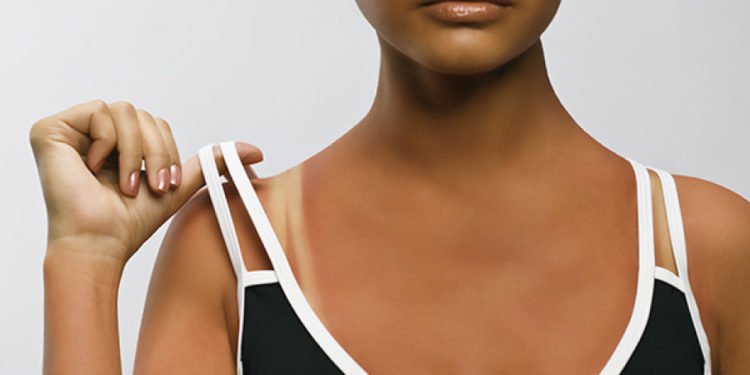 8 reasons why you should take your skin tanning seriously