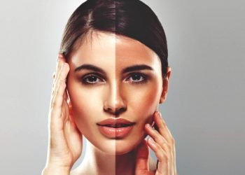 Guaranteed Solution for Skin Tanning Issue