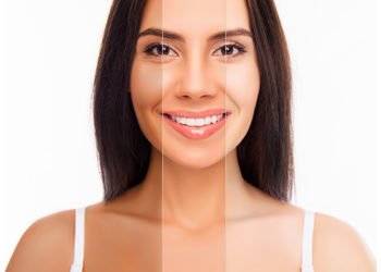 Skin Whitening Procedures at Clinics