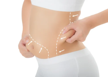 How Liposuction Surgery Can Help You Achieve Your Ideal Body