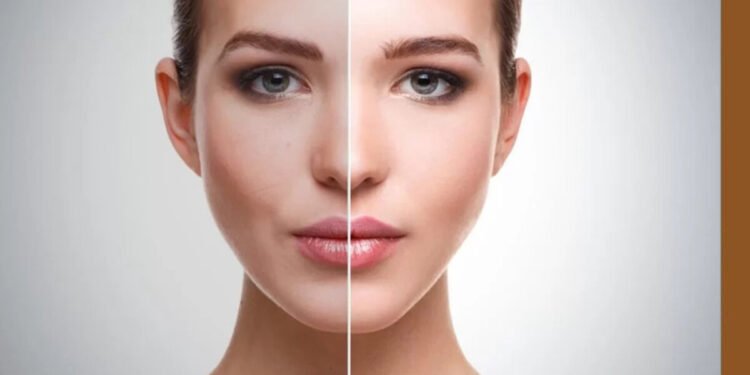 Skin Whitening Treatment, Procedures, Cost, And Side Effects
