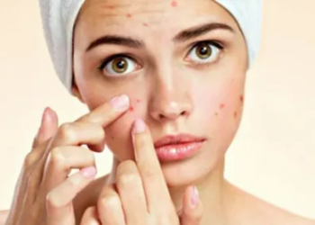 The Best Treatment For Acne In Mumbai