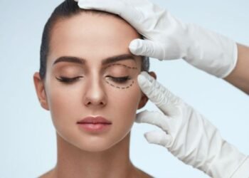 5 Reasons You Should Consider Eyelid Surgery