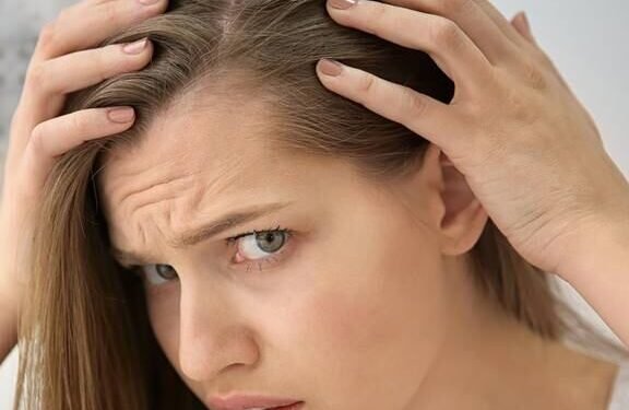 Choosing the Right Treatment for Hair Loss
