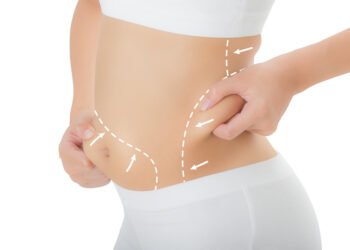 Is Liposuction Surgery Risky?