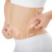 Is Liposuction Surgery Risky?