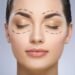 Ptosis Surgery Treatment and Management