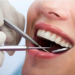 Top 5 Most Common Dental Treatments