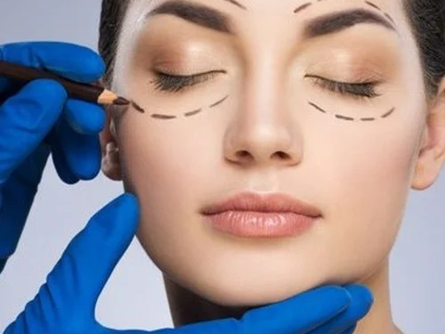 Who Makes a Good Candidate for Eyelid Surgery?